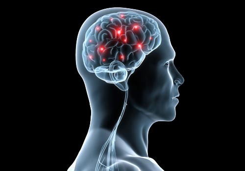 Types of Migraines