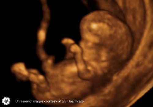 Week 12: Pregnancy Week By Week 3D Ultrasound Images