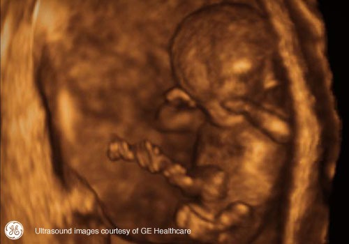 Week 13: Pregnancy Week By Week 3D Ultrasound Images