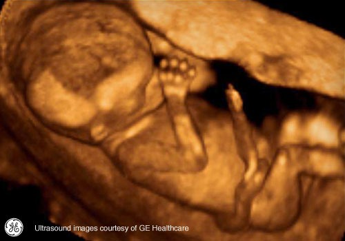 Week 14: Pregnancy Week By Week 3D Ultrasound Images