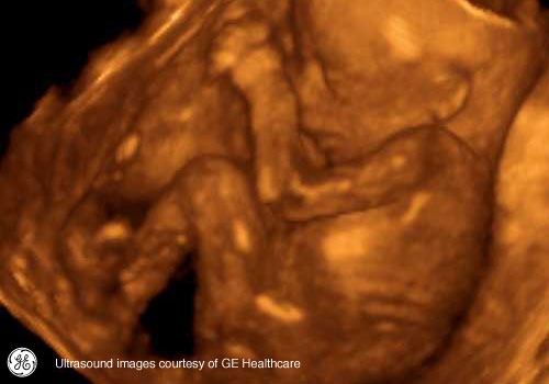 Week 19: Pregnancy Week By Week 3D Ultrasound Images