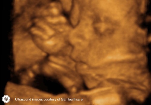 Week 24: Pregnancy Week By Week 3D Ultrasound Images