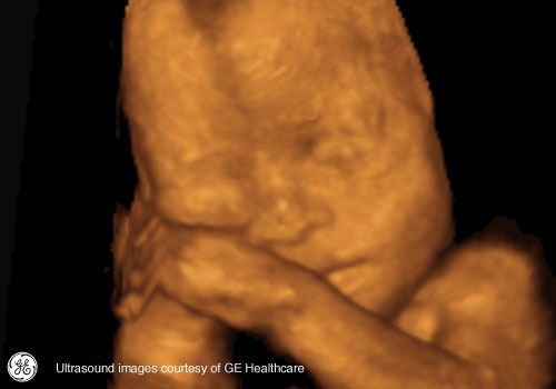 Week 25: Pregnancy Week By Week 3D Ultrasound Images