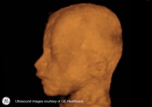 Week 27: Pregnancy Week By Week 3D Ultrasound Images
