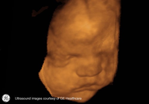 Week 29: Pregnancy Week By Week 3D Ultrasound Images