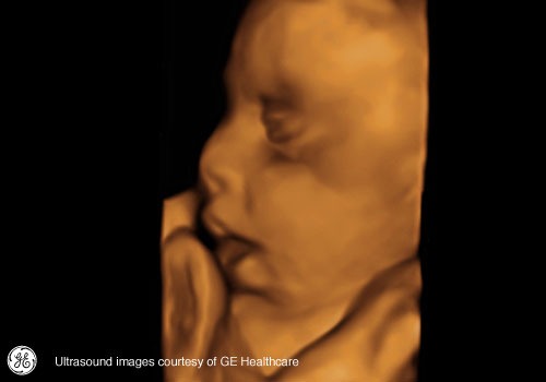 Week 30: Pregnancy Week By Week 3D Ultrasound Images