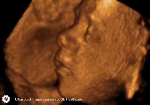 Week 31: Pregnancy Week By Week 3D Ultrasound Images