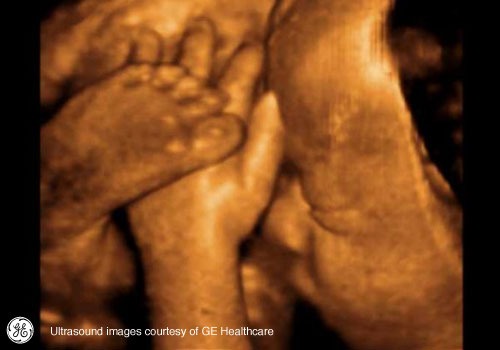 Week 32: Pregnancy Week By Week 3D Ultrasound Images