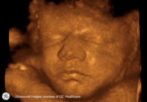 Week 34: Pregnancy Week By Week 3D Ultrasound Images