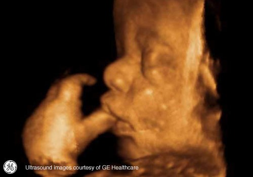 Week 35: Pregnancy Week By Week 3D Ultrasound Images