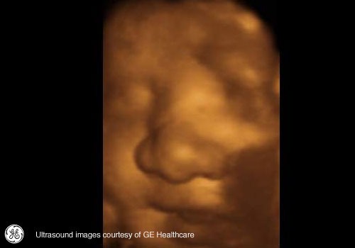 Week 38: Pregnancy Week By Week 3D Ultrasound Images
