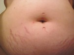 My stomach. The angle doesn't help much either.