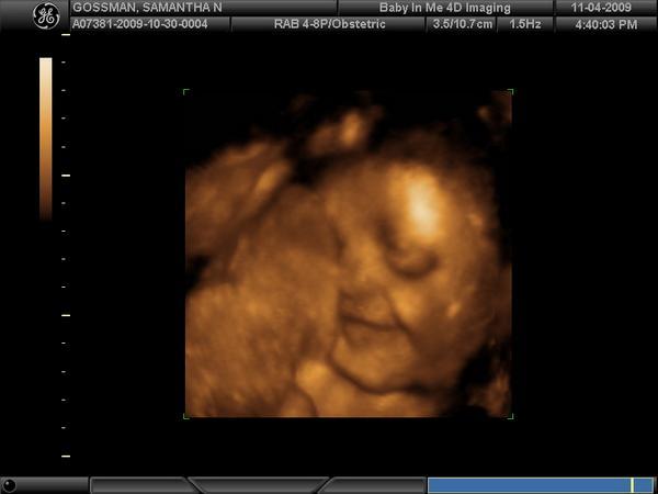 Our little angel at 34 weeks!