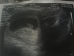 Nov 17th,2009. 7wks 3days ultrasound