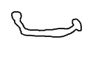 malformed hyoid bone drawing