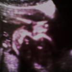 19 weeks 6 days.. shes got her hand up by her face. :)