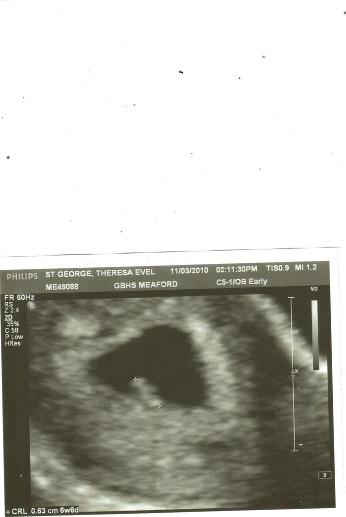 my ultrasound at 6w 5d