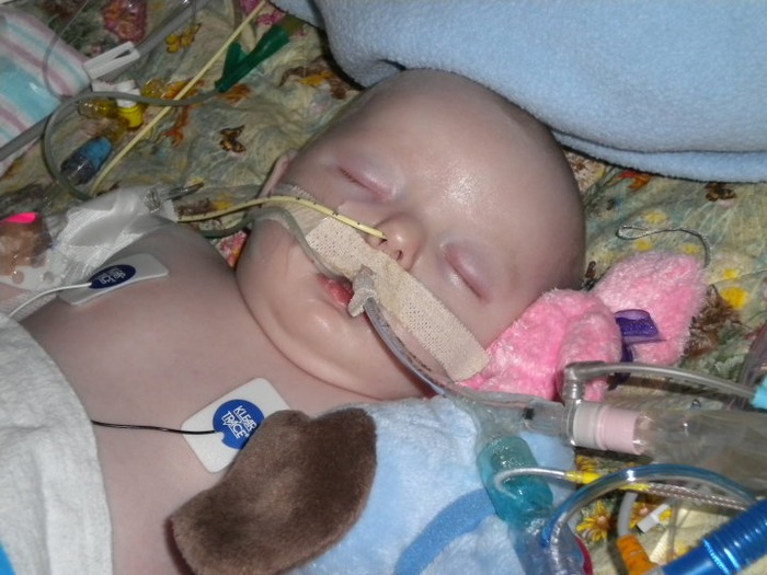 My daughter on life support in portland. she was life flighted for rsv, bronchiolitis and sepsis.