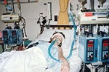 first transplant in 1990