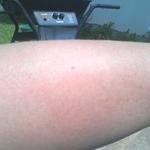 My arm 3 mins after being in sun....