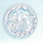 our day 5 embryo implanted 19MAY10