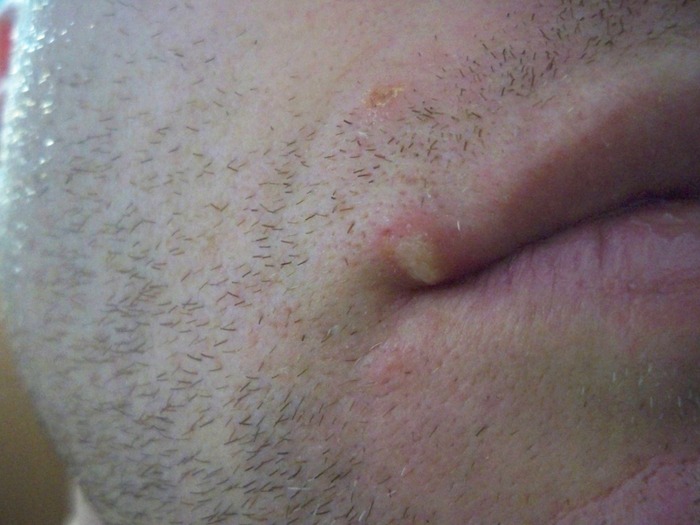 new skin condition...help please...