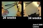 Comparison 24 weeks and 34 weeks