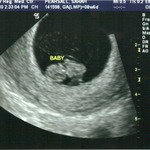 first ultrasound- 8 weeks