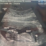 last ultrasound of my precious baby KC week before my m/c