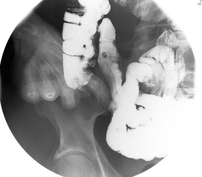 appendix X-ray 01