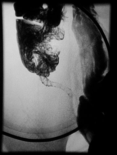 appendix X-ray 03