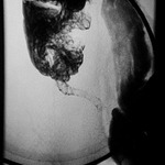 appendix X-ray 03