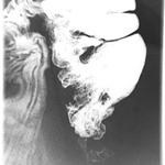 appendix X-ray 05