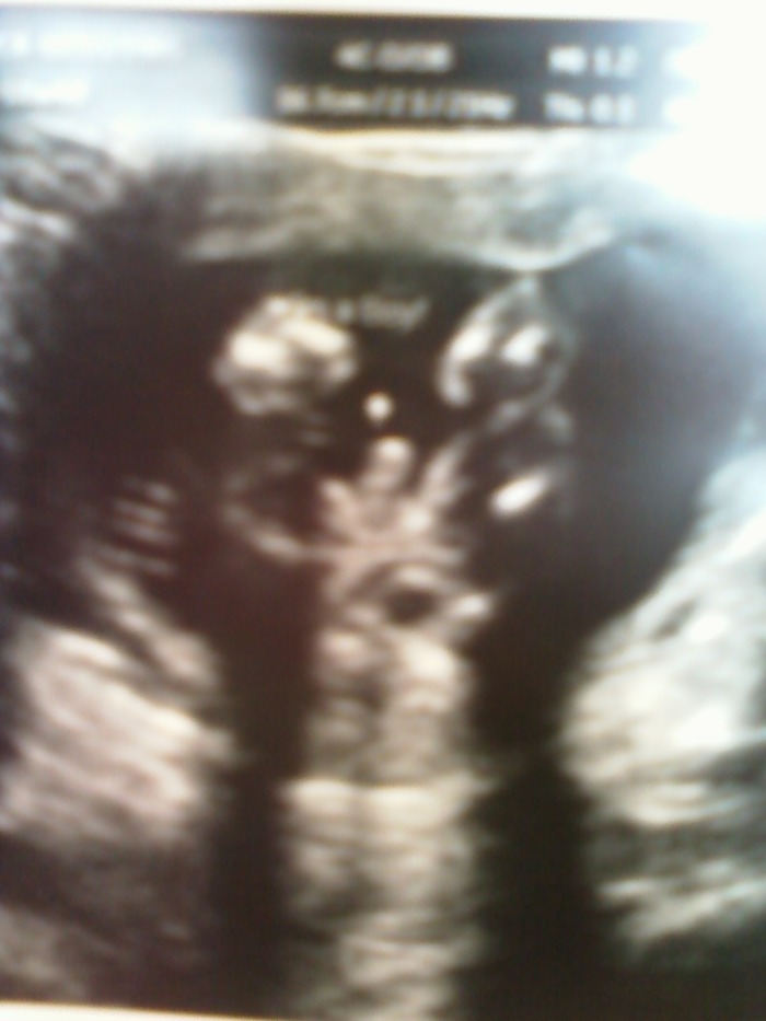 It's a boy!!