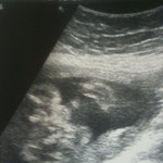 the confirmed ultrasound lol :)