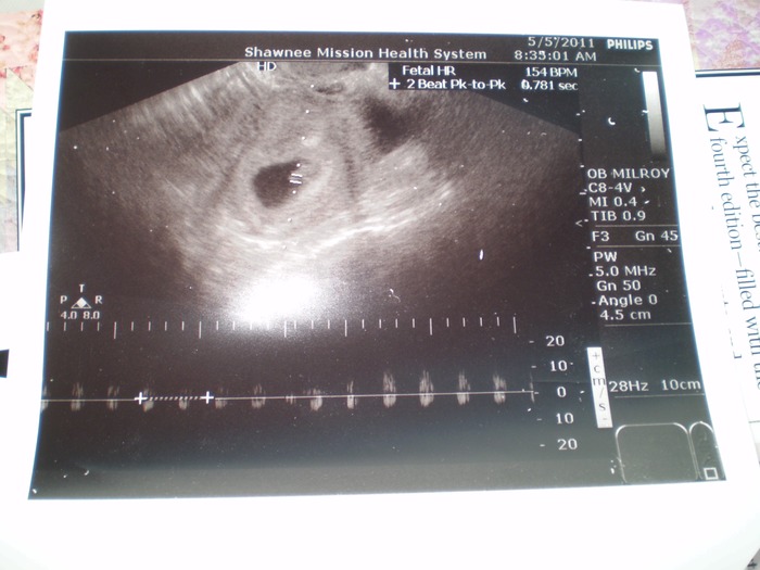 measuring BPM -- 176;  very healthy number at 7 wks, 5 days