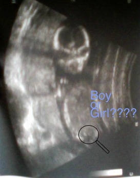 16 week Ultrasound Front View, Boy or Girl?