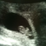 My first ultrasound at 9 weeks!