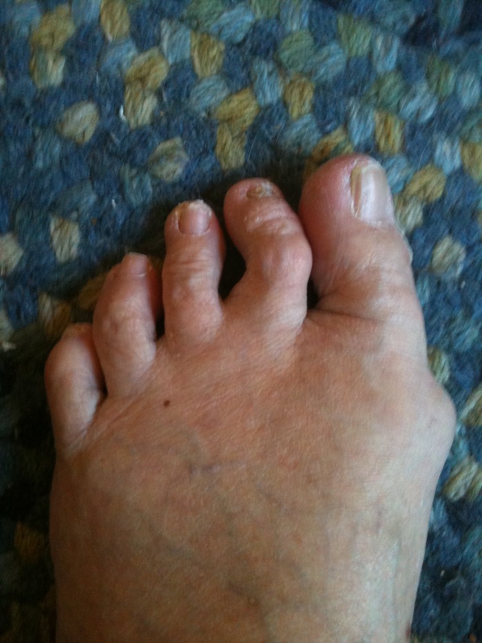 foot AND toes Hurt--podiatrist?