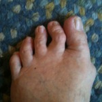 foot AND toes Hurt--podiatrist?