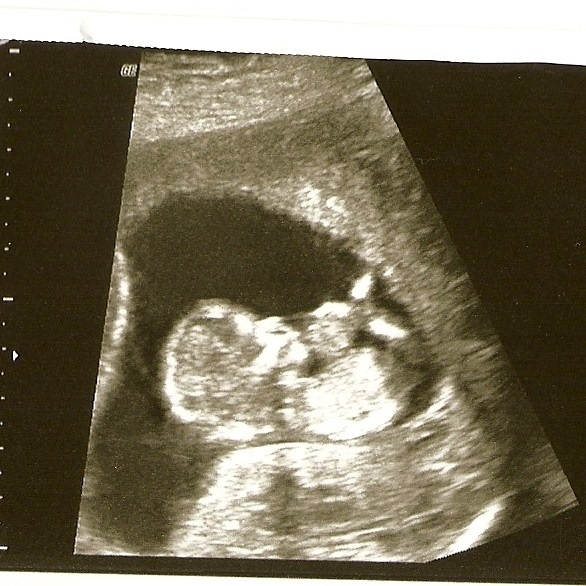 Baby May 2011