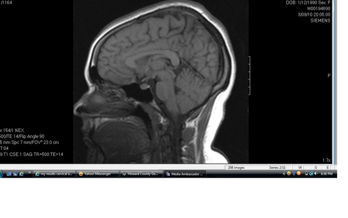 Not sure but I print screened this from the mri cd because it would not copy from the actual cd