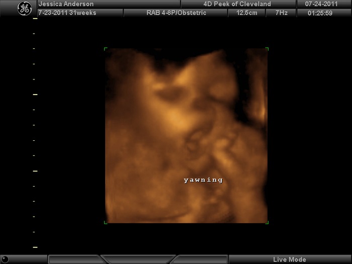 3D/4D ultrasound....  so happy we got to go! 