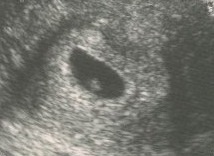 6 week scan - My little blueberry