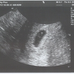 6 weeks exactly - we saw the heartbeat!