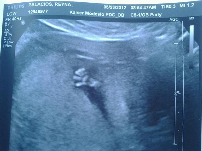 i love that i got to see  my baby hand love you baby  12w5d