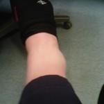 ankle after I fell