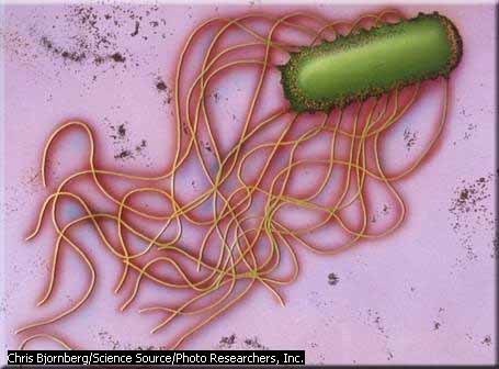 Another pic of bacteria
