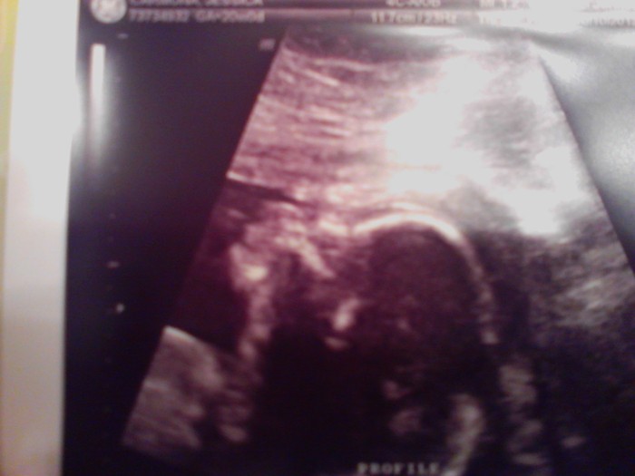 My baby girl with her mouth open :)