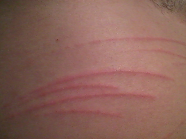 Up close of the same scratches 